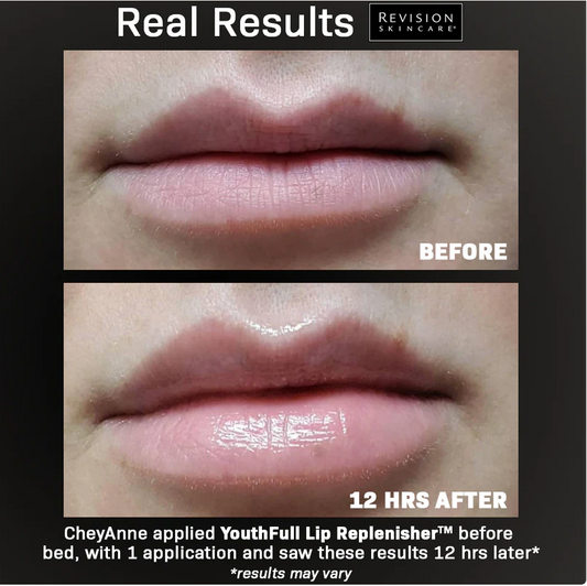 Revision Skincare® YouthFull Lip Replenisher™
