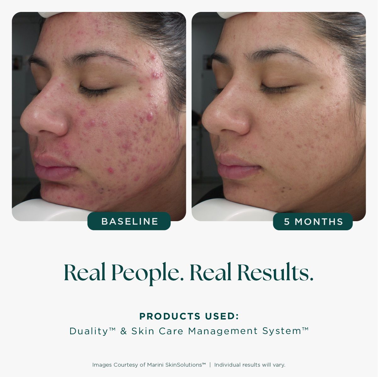 Marini Skinsolutions Age Intervention™ Duality™ Original or MD Strength