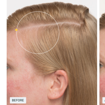 Nutrafol Women's Balance Hair Growth Pack (45+)
