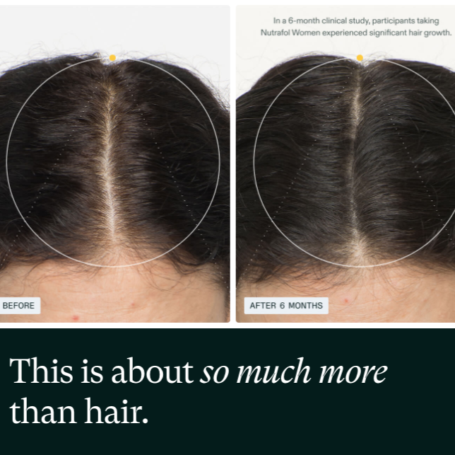 Nutrafol Women’s Hair Growth Pack (Ages 18–44)