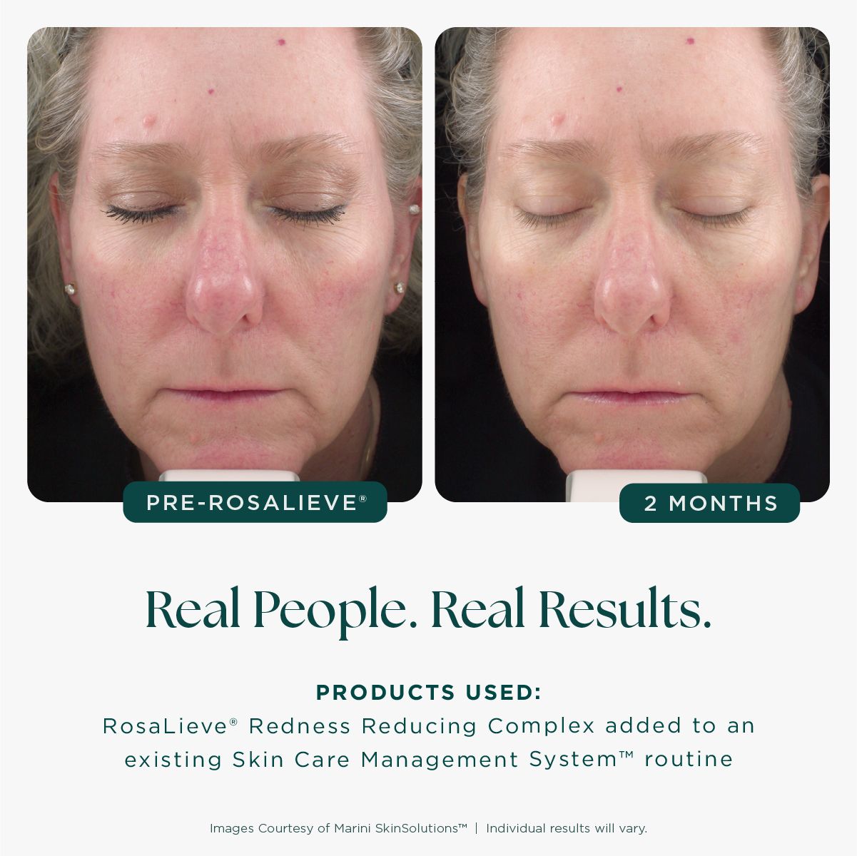 Marini Skinsolutions Rosalieve Redness Reducing Complex